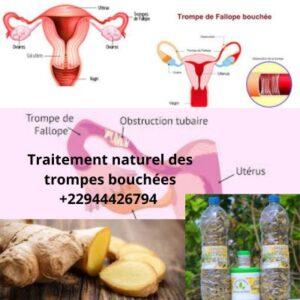 Traitement naturel des trompes bouchees 22944426794 300x300